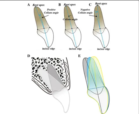 Fig. 7 The various Collum angle in central incisor, the long axis of the root can deviate to the labial side (a) or lingual side (c) of the long axis ofthe crown, or coincidence (b)
