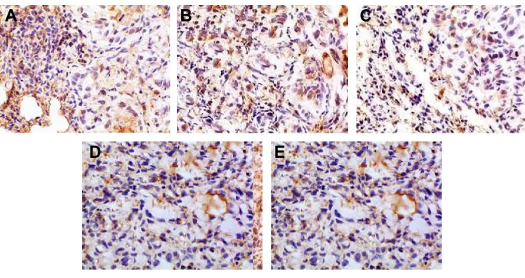 Figure 13 Immunohistochemical staining for Il-8 of orthotopic tumors in all the groups.Notes: (A) Positive group, (B) combination group, (C) test group, (D) reference group, and (E) model group