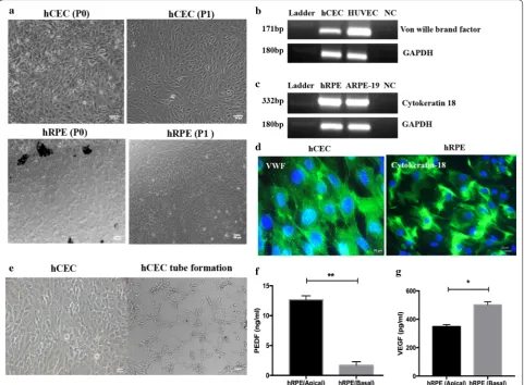 Fig. 2 Images of human primary ocular cells. a Top left panel shows human microvascular choroidal endothelial cells (hCEC) freshly isolated (P0) and the first passage (P1) on the right side