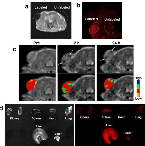 Figure 1.12: a) In vivo T 2 -weighted MR and b) fluorescence images of subcutaneously  injected MCF-7 cells labeled with Fe 3 O 4 @MSN and control cells