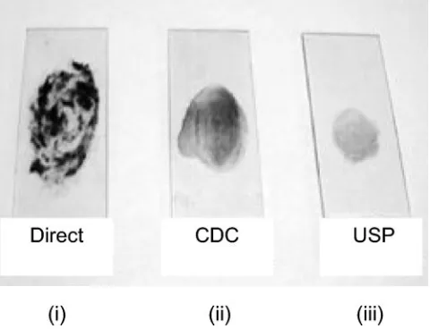 TABLE 2. Results of Ziehl-Neelsen staining of sputum smearsprepared by USP and CDC methods