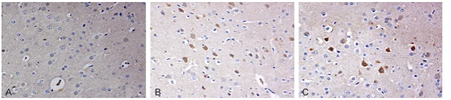 Table 2. Comparison of the rate of Homer1a positive cells in cortex (%/view, _x ±s)
