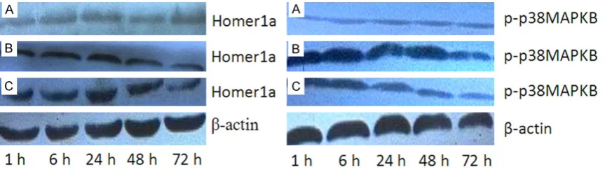 Figure 4. Homer1a protein and phosphorylated p38MAPK in rat cortex from various group by Western-Blot