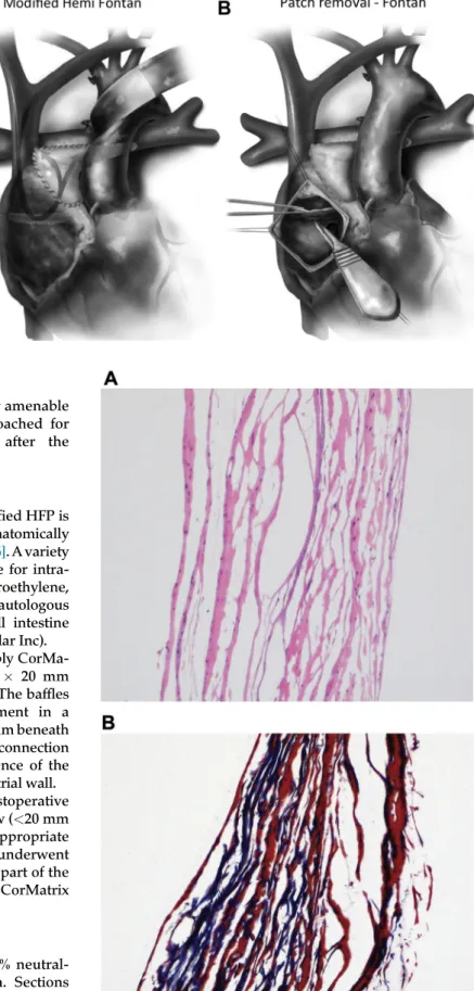 Fig 2. (A) Control; collagen and ghost outlines of nuclei are shown.