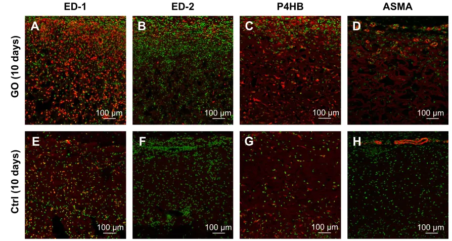 Figure 4 rat subcutaneous tissue response to gO scaffold.Notes: Histological findings for control (A–C), 0.1 µg/ml gO scaffold (D–F), and 1 µg/ml gO scaffold (G–L) in rat subcutaneous tissue at 10 days