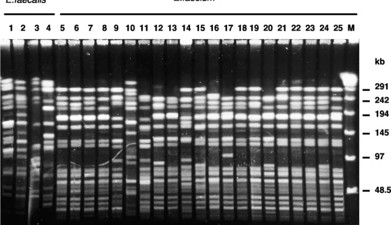 FIG. 1. PFGE proﬁles of bloodstream-infecting VRE isolates. Lanes 1 to 4, VREﬂ isolates of different PFGE types