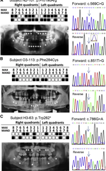 Figure 2C) was identified in subject H3-63. This mutation was predicted to produce a truncated protein (missing 128 amino acids at the C terminus) and thereby disrupt the protein’s function