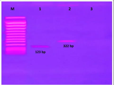 Figure 1 Gel electrophoresis of conventional multiplex PCR result. M, molecular weight Marker; line 1, M