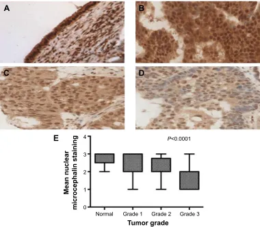 Figure 4 Glucose metabolism is increased in cancer cells and could produce an acidic environment that may promote degradation of the extracellular matrix and influence local cellular invasion.Notes: estrella et al15 evaluated in vivo pH and its role on tum