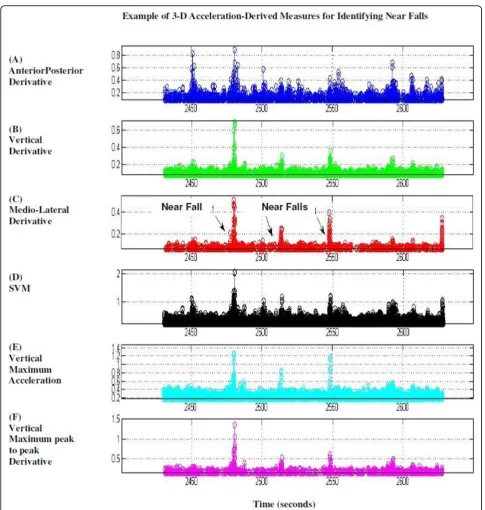 Figure 3 Acceleration derived signals during 3 near falls, as labeled, and during other gait intervals