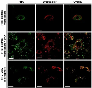 Figure 6 Fluorescence and overlay images of 3T3 cells stained with LysoTracker Red following treatment with FITC–dextran-containing microspheres without DNA (top row), FITC–dextran-containing microspheres with DNA (middle row), and FITC-DNA-containing microspheres (bottom row).Note: Magnification ×1000; scale bar =10 µm.Abbreviation: FITC, fluorescein isothiocyanate.