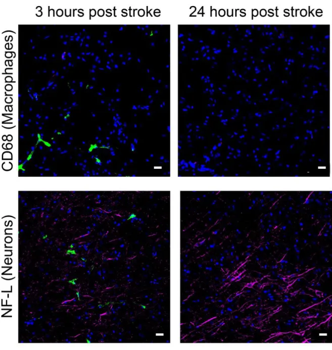 Figure  2.2  Cl-nanozyme  in  the  brain  does  not  co-localize  with  neuron  or  activated  macrophages