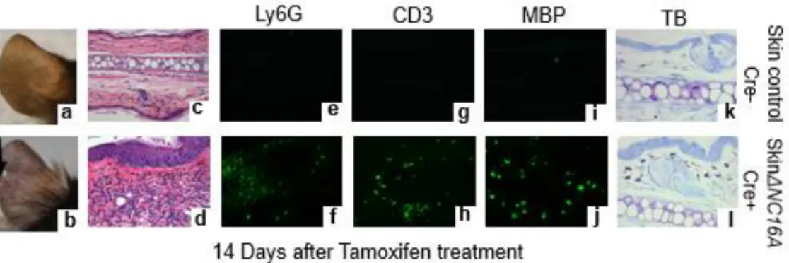 Fig. S2.2. Skin-specific ΔNC16A is sufficient to promote skin inflammation. We  found TamCre-NC16A mice started to develop spontaneous skin inflammation at 