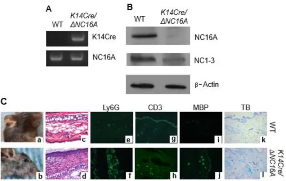 Fig. S2.5. Generation of basal keratinocyte conditional K14Cre/ΔNC16A mice. A. 