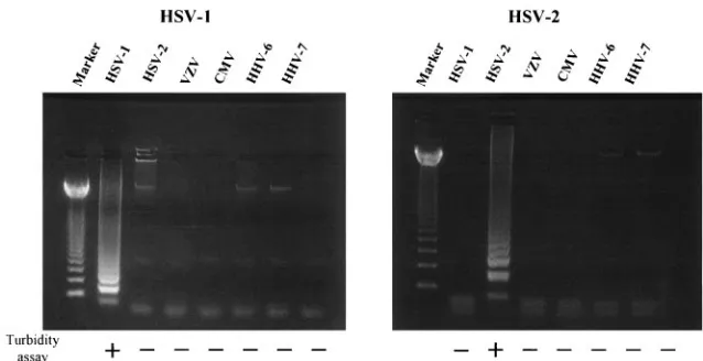 FIG. 2. To determine the respective sensitivities of each assay, serial dilutions of pGEMHS1 and pGEMHS2 plasmid DNAs were ampliﬁed bythe HSV-1- and HSV-2-speciﬁc LAMP, respectively