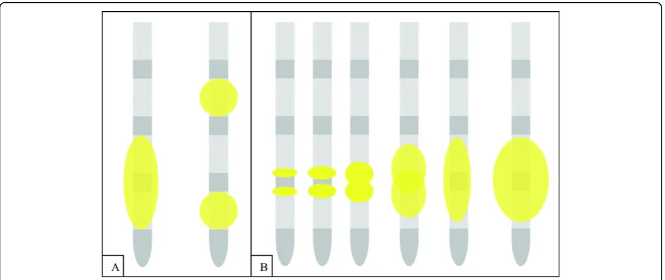 Figure 3 Example of the development of a lesion obtained with 1.73 Watt over 120 seconds