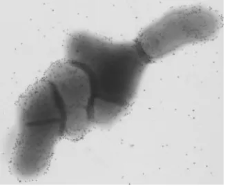 FIG. 1. Micrographs of P. acnesstained with Evans blue and viewed with a combined red/green ﬁlter ( immunolabeled with a mouse MAb and an FITC-conjugated anti-mouse antibody