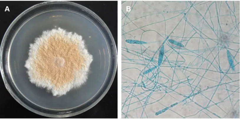 Figure 1 Morphology of Arthroderma fulvum (strain hT77).Notes: (A) Macroscopic morphology (PDa, 28°c, 9 days) and (B) microscopic morphology (×400, stained with lactophenol cotton blue).Abbreviation: PDa, potato dextrose agar.