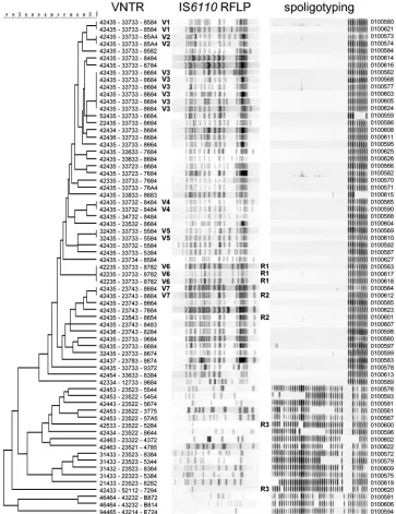 FIG. 1. DNA ﬁngerprint results for 69 M. tuberculosisdetermined by the unpaired group method using arithmetic averages algorithm (dendrogram with similarity indicated on top, utmost left)