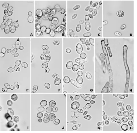 FIG. 5. (A and B) K. bovinaNRRL Y-27499: (C) budding cells; (D) ascus with an ascospore, YM agar, 25 days