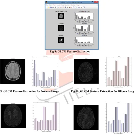 Fig 8: GLCM Feature Extraction 