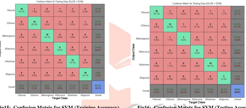 Fig 13: GLCM Feature Extraction for Alzheimer Image           Fig 14: GLCM Feature Extraction for Agnosia Image 