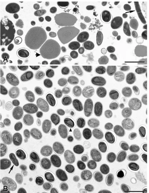FIG. 3. Transmission electron micrographs of material obtained after isopycnic Percoll and 40 to 60% (wt/wt) sucrose gradient centrifugations.(A) Material contained in band 2 (bottom band) of the isopycnic Percoll gradient centrifugation