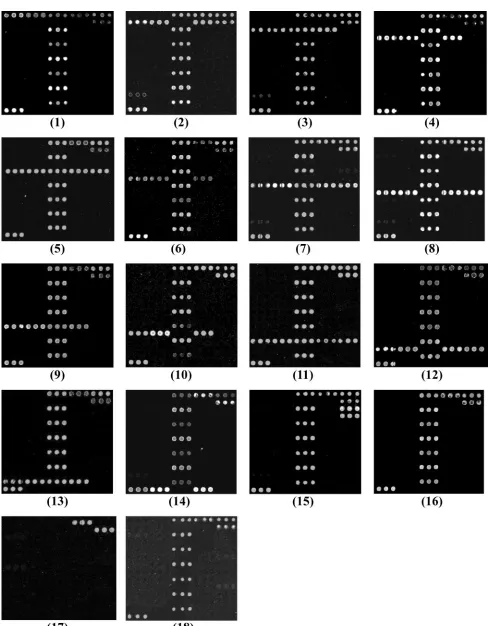 FIG. 3. Microarray differentiation of the pathogens. (1) S. ﬂexneri(4)E. colior Shigella type 2a and E