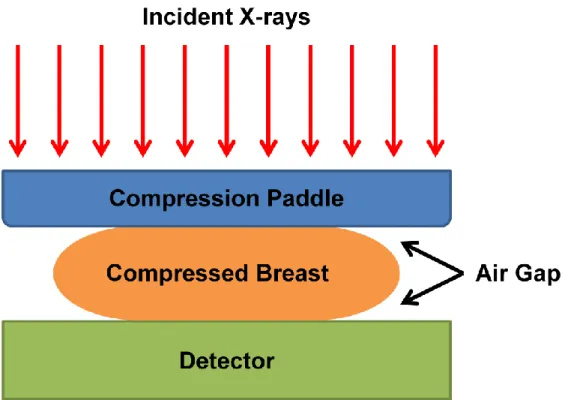 Figure 6:  Diagram showing the non-uniformity of breast thickness that occurs even after compression of  the breast