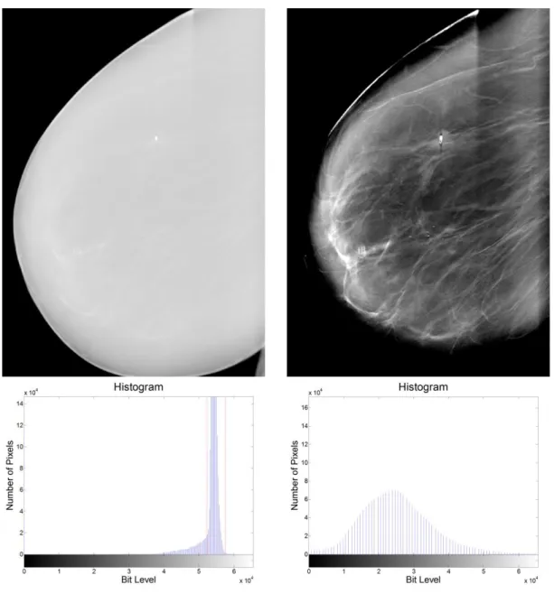 Figure 9: Left - An MLO image of a breast (Above) without adjusting the image (Below)