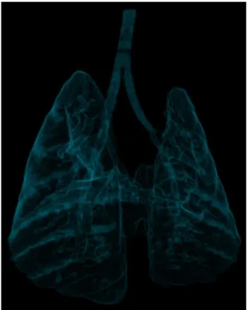 Figure 14: A 3D visualization of the lungs of a mouse imaged on the CNT based micro-CT system