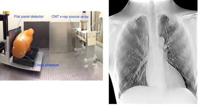 Figure 18: Left - Image of the prototype stationary chest tomosynthesis system.  Right - Reconstruction  slice of a chest phantom using the system