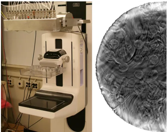 Figure 19: Left - Image of the prototype s-DBT system.  Right - Reconstruction slice of a breast phantom  using the s-DBT system
