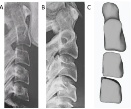 Figure  1.  Survey  Image  Presentation.  Three  lateral  views  of  the  cervical  vertebrae  as  seen  by  participants
