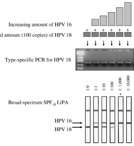 TABLE 2. Detection of HPV-16 by SPF10 LiPA andtype-speciﬁc PCR
