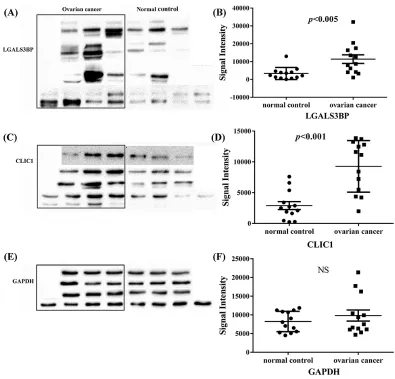 Figure 3: Western blot analysis of LGALS3BP and CLIC1 in all tissue samples of ovarian cancer and normal control