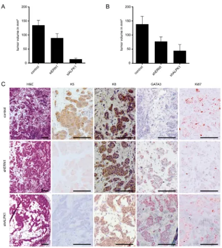 Figure 5: Early ERN1 and ALPK1 knockdown tumors differ in expression pattern or phenotype from control tumors.A