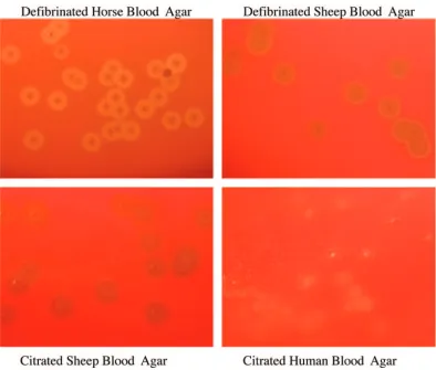 TABLE 2. Appearances of colonies and zones of hemolysis for tested strains on four different blood agar plates