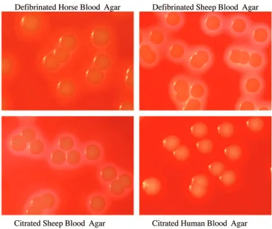 FIG. 2. Growth of S. aureus ATCC 25923 on the four different blood agars at a dilution of 1 � 102 CFU/ml.