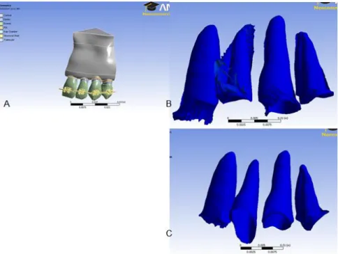 Figure 11. A) Shows orientation of the complete model before removing all tissues but the PDL