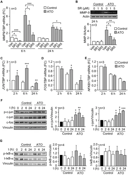 Figure 5: The AP-1 transcription factor is responsible for the upregulation of MMP-9 by ATO