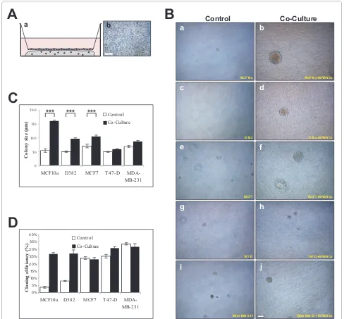 Figure 5 Endothelial-derived effects are mediated trough soluble factorsproliferation of MCF7 (