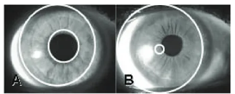 Figure 1 Segmentation error rates. The segmentation error rate is defined visually as (a) slight; and (b) extreme.