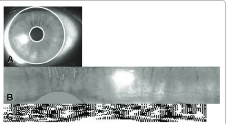 Figure 2 Iris normalisation and encodingor to normalisation and encoding; (b) Normalised iris showing iris re-mapped from Cartesian coordinates to a doubly dimensionless non-