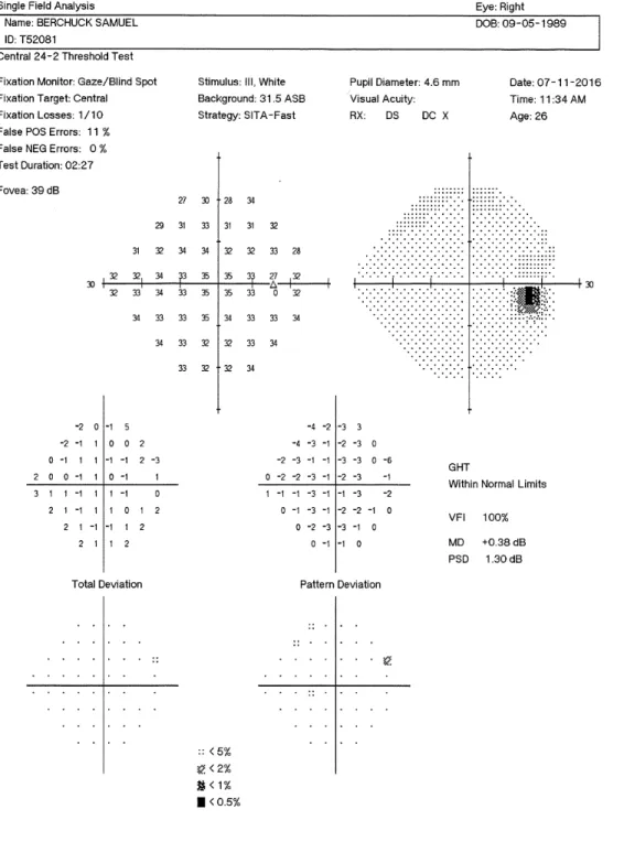 Figure 1.1: Visual field output for a normal eye.