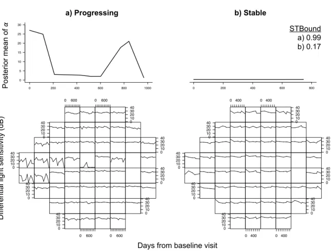Figure 3.8: Longitudinal series of VFs for one progressing (left) and stable (right) eye are presented in the bottom row