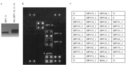 FIG. 1. HPV typing by multiplex/APEX assay with an artiﬁcial mixture of HPV DNAs. (A) Gel image of multiplex PCR ampliﬁcation productsfrom an artiﬁcial mixture of three HPV types (types 18, 31, and 56) mixed with human genomic DNA extracted from the HPV-negative cervical