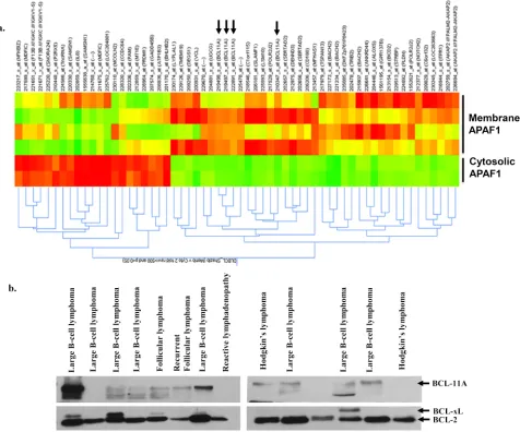 Figure 6: Higher expression of BCL11A in B-cell Lymphoma. a. Gene expression profiling and analysis was done using Affymetrix HG-U133 Plus 2 microarray chips