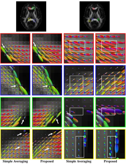 Figure 12.  Normal-quality data. Comparisons of white matter fiber ODFs given by the simple averaging  method (columns 1 and 3) and our method (columns 2 and 4)