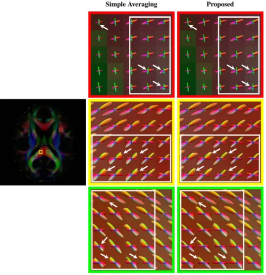 Figure 6.  Axial view of ODFs. ODFs estimated using simple averaging and the proposed method